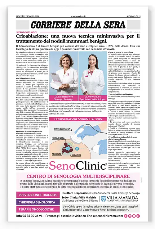 advertorial-crioablazione di un nodulo mammario